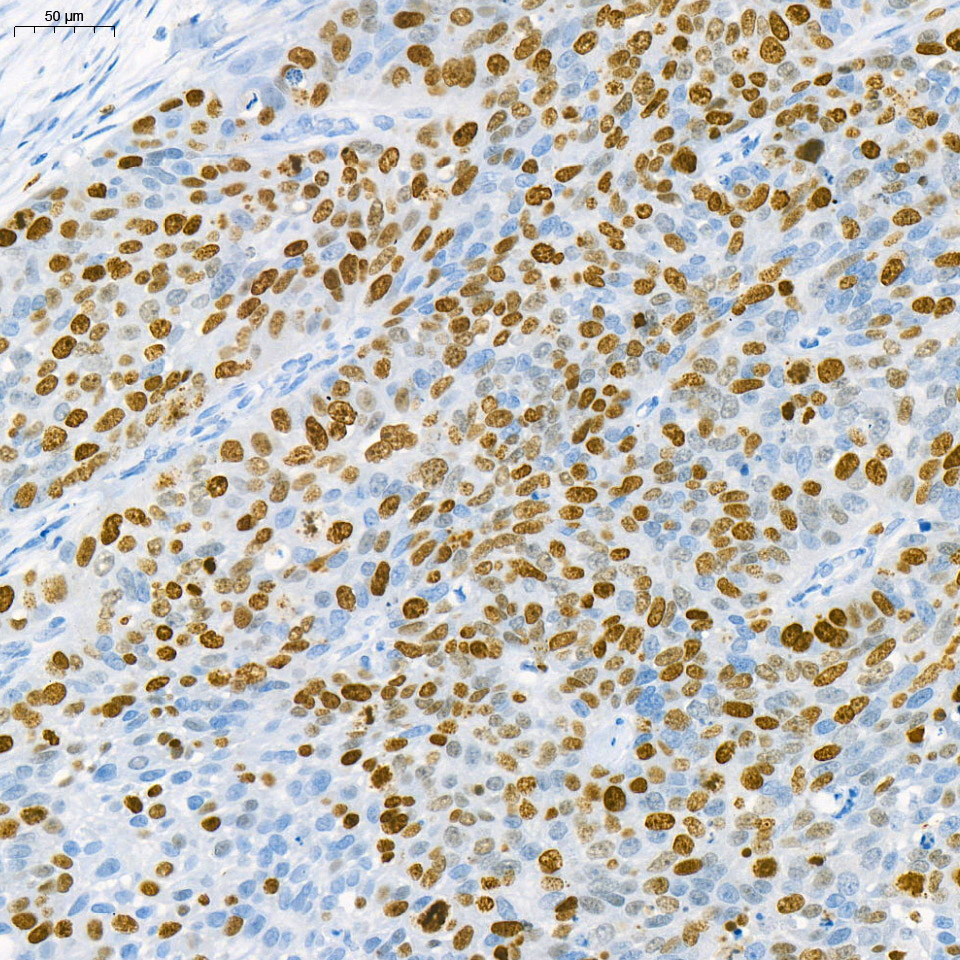 Anti -Ki67 Mouse mAb （ABC121159）