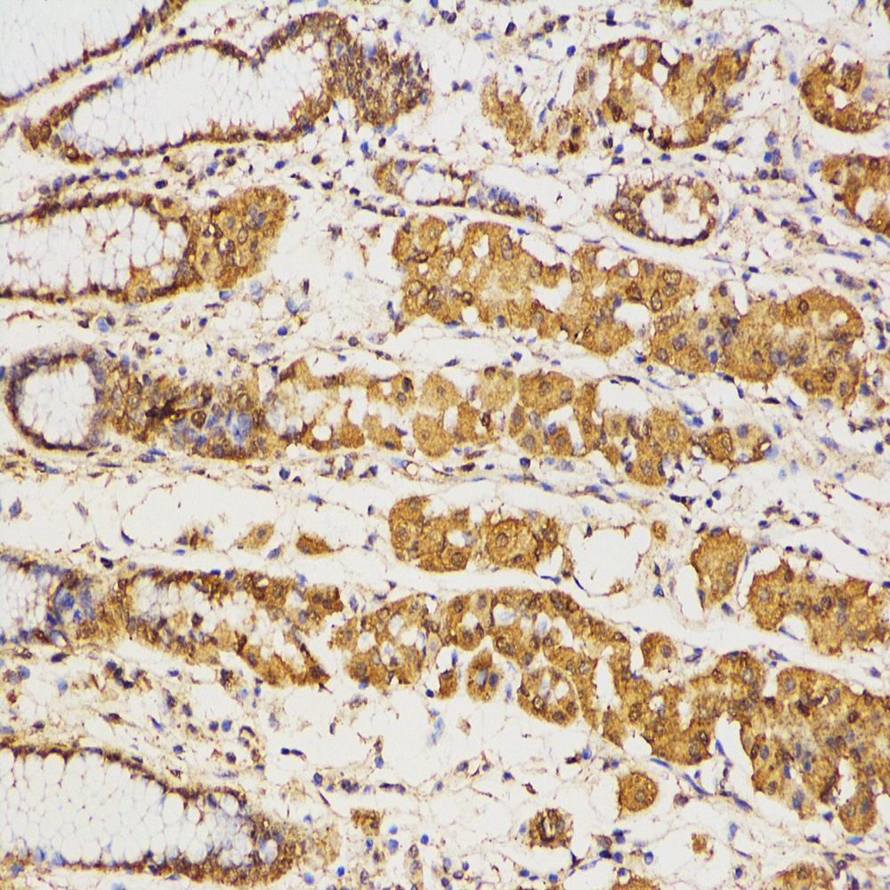 Anti -GAPDH Mouse mAb （ABC12020）