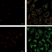 JC-1 Mitochondrial Potential Probe（线粒体荧光探针）（ABC346）