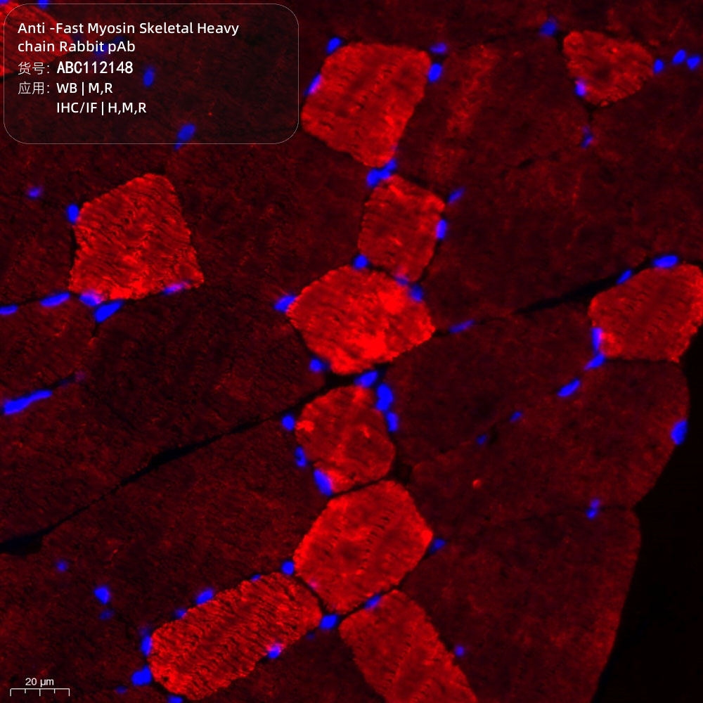 Anti -Fast Myosin Skeletal Heavy chain Rabbit pAb （ABC112148）