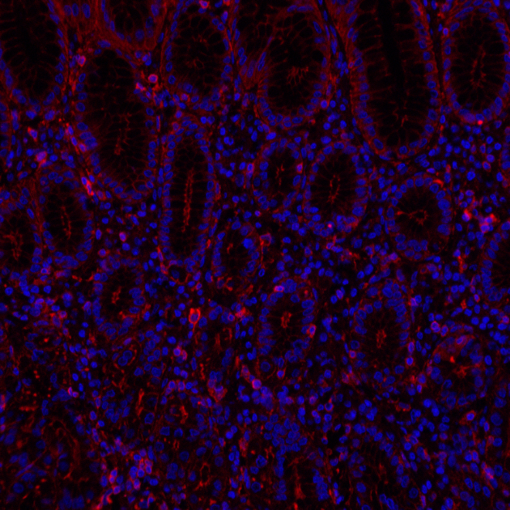 Anti -beta Actin Rabbit pAb （ABC11019）