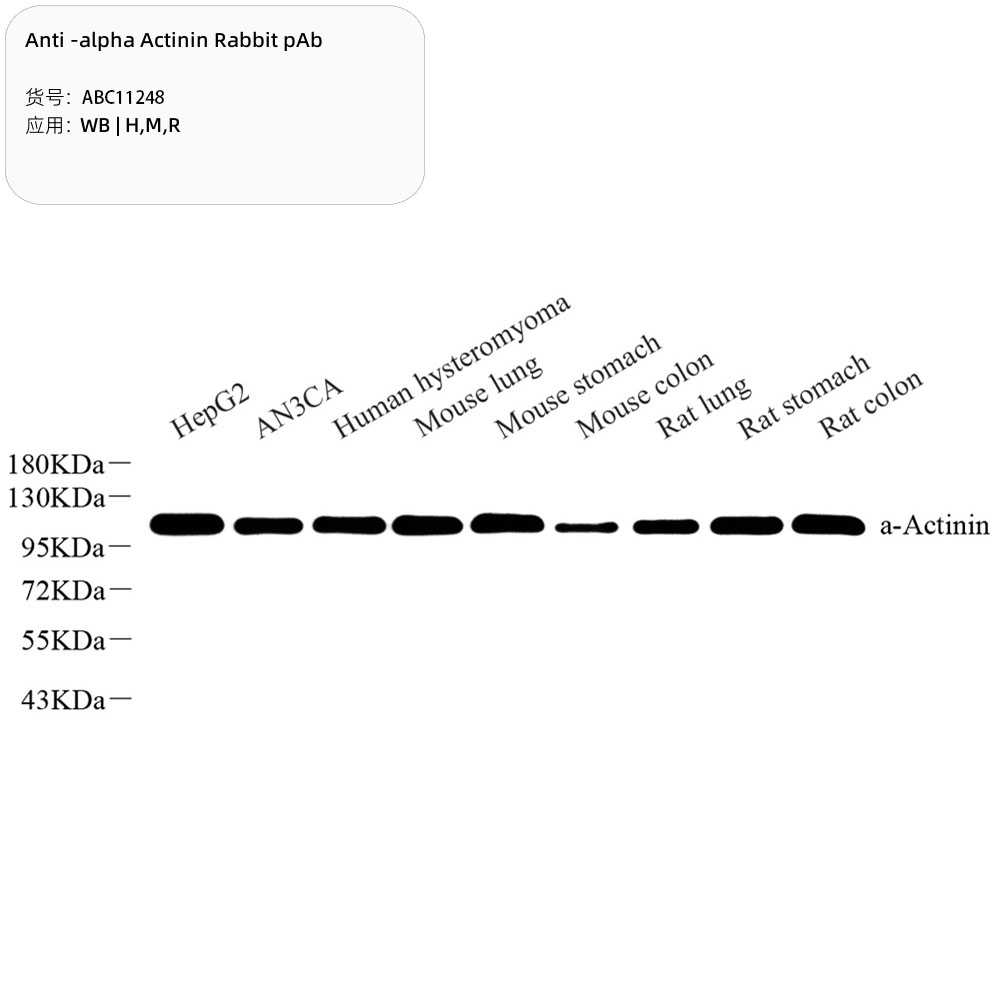 Anti -alpha Actinin Rabbit pAb （ABC11248）