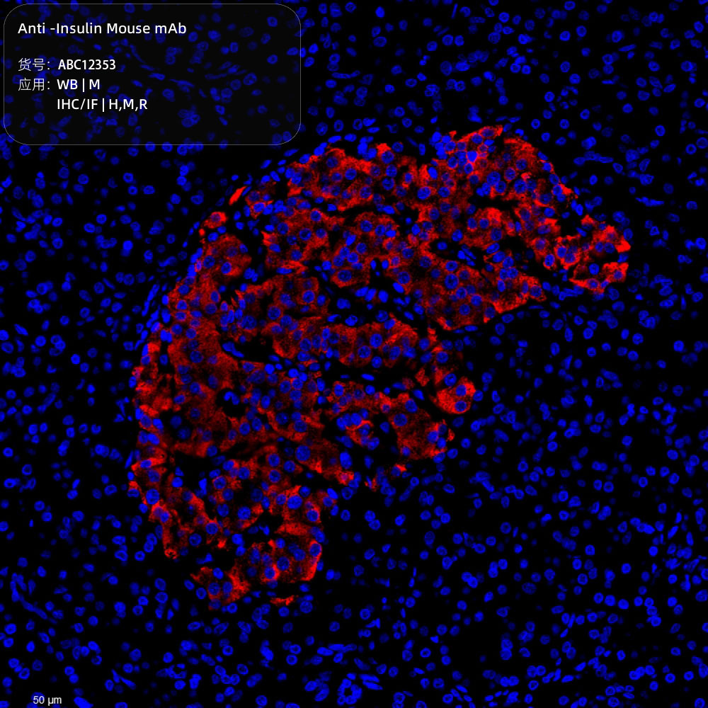 Anti -Insulin Mouse mAb （ABC12353）