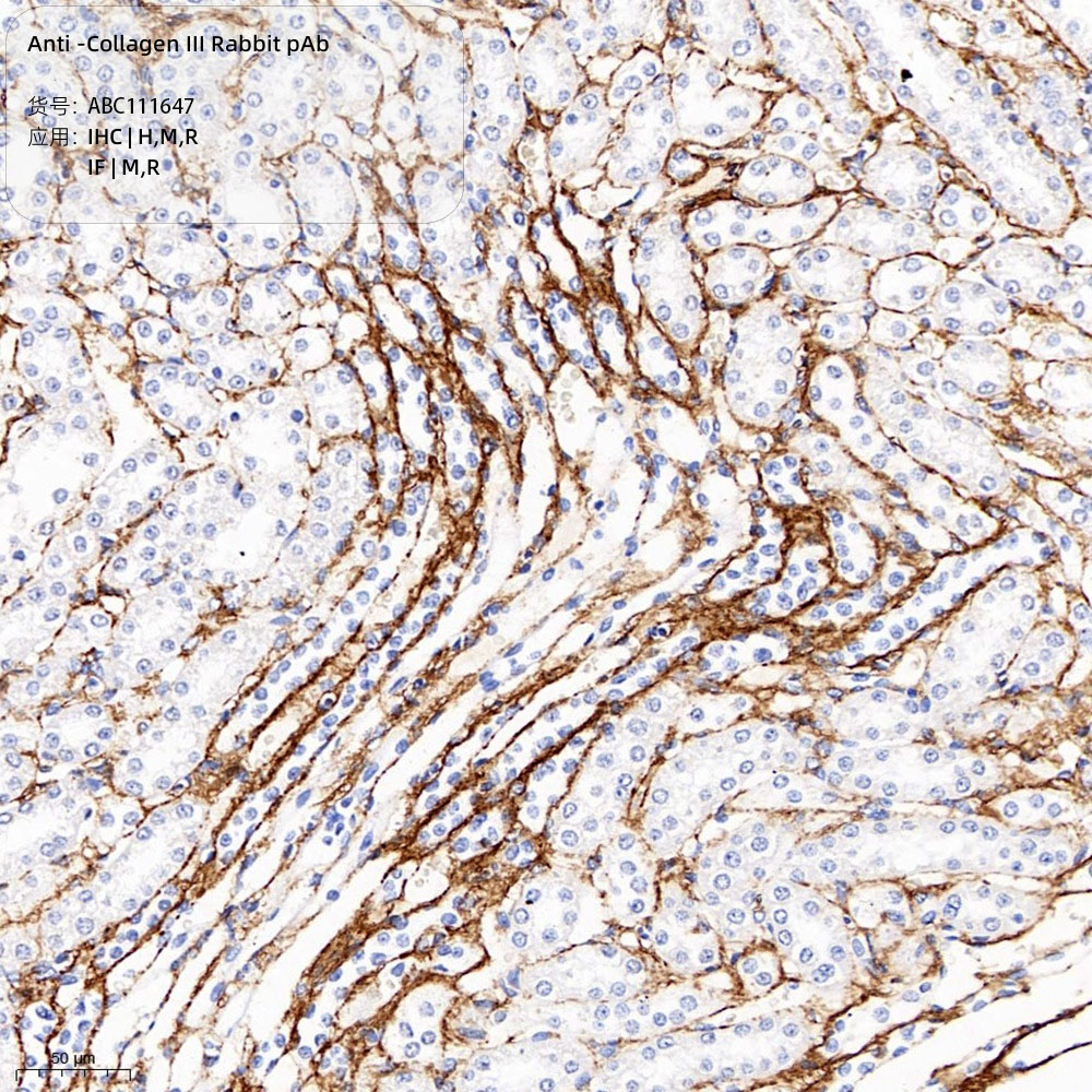 Anti -Collagen III Rabbit pAb （ABC111647）