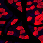 Anti -Slow Skeletal Myosin Heavy chain Rabbit pAb （ABC111875）